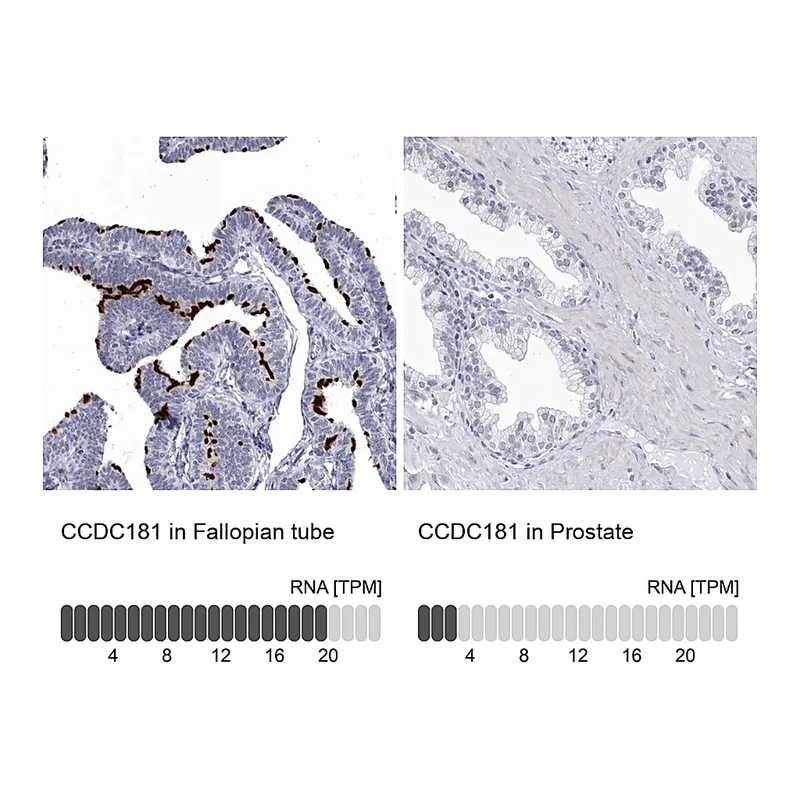 Atlas Antibodies Anti-CCDC181 Antibody