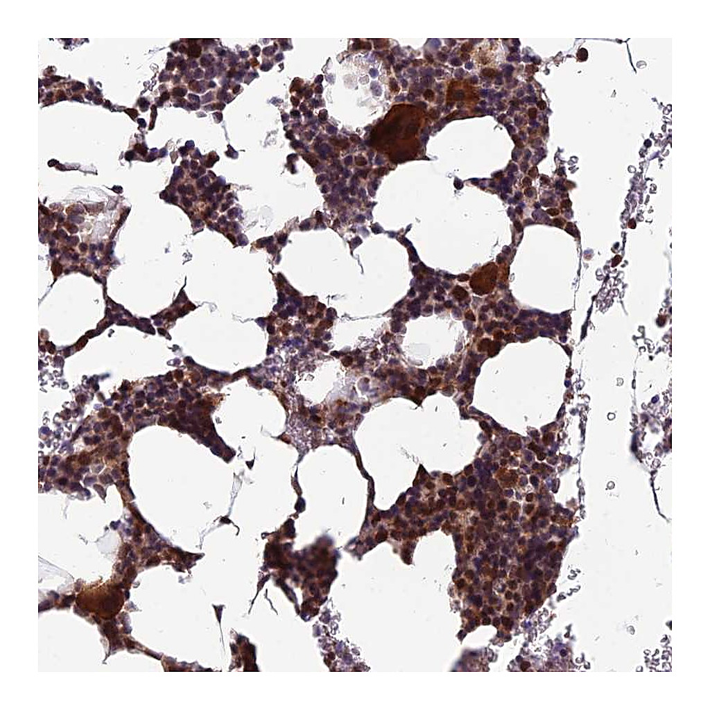 Atlas Antibodies Anti-CCDC183 Antibody