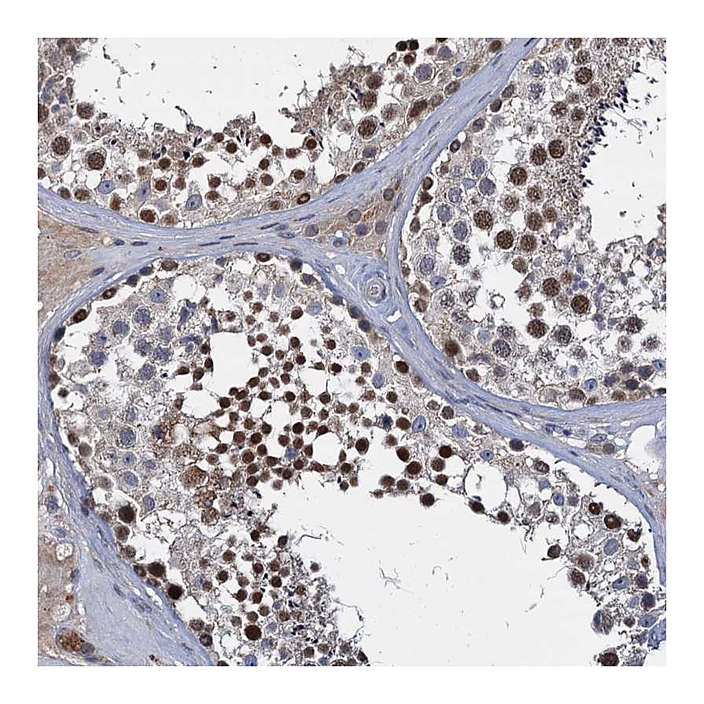 Atlas Antibodies Anti-CCDC184 Antibody