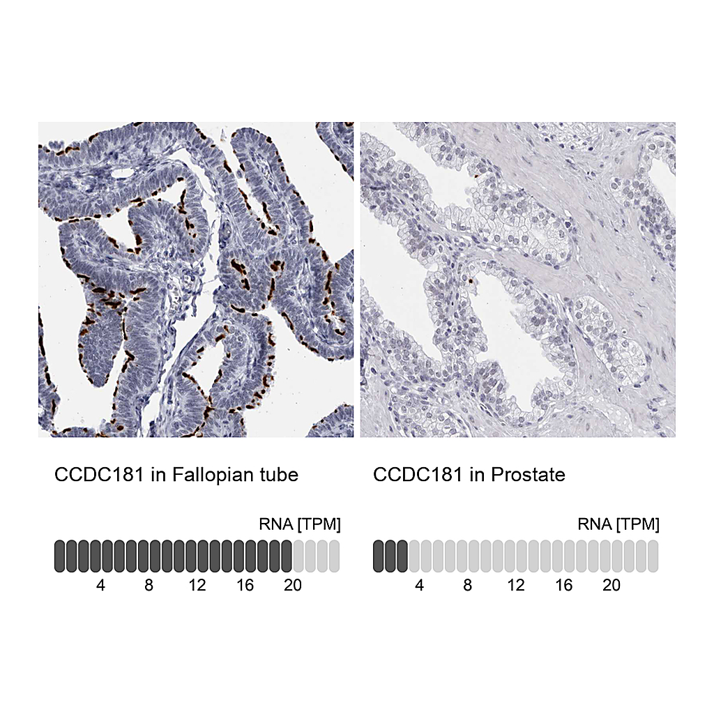 Atlas Antibodies Anti-CCDC181 Antibody