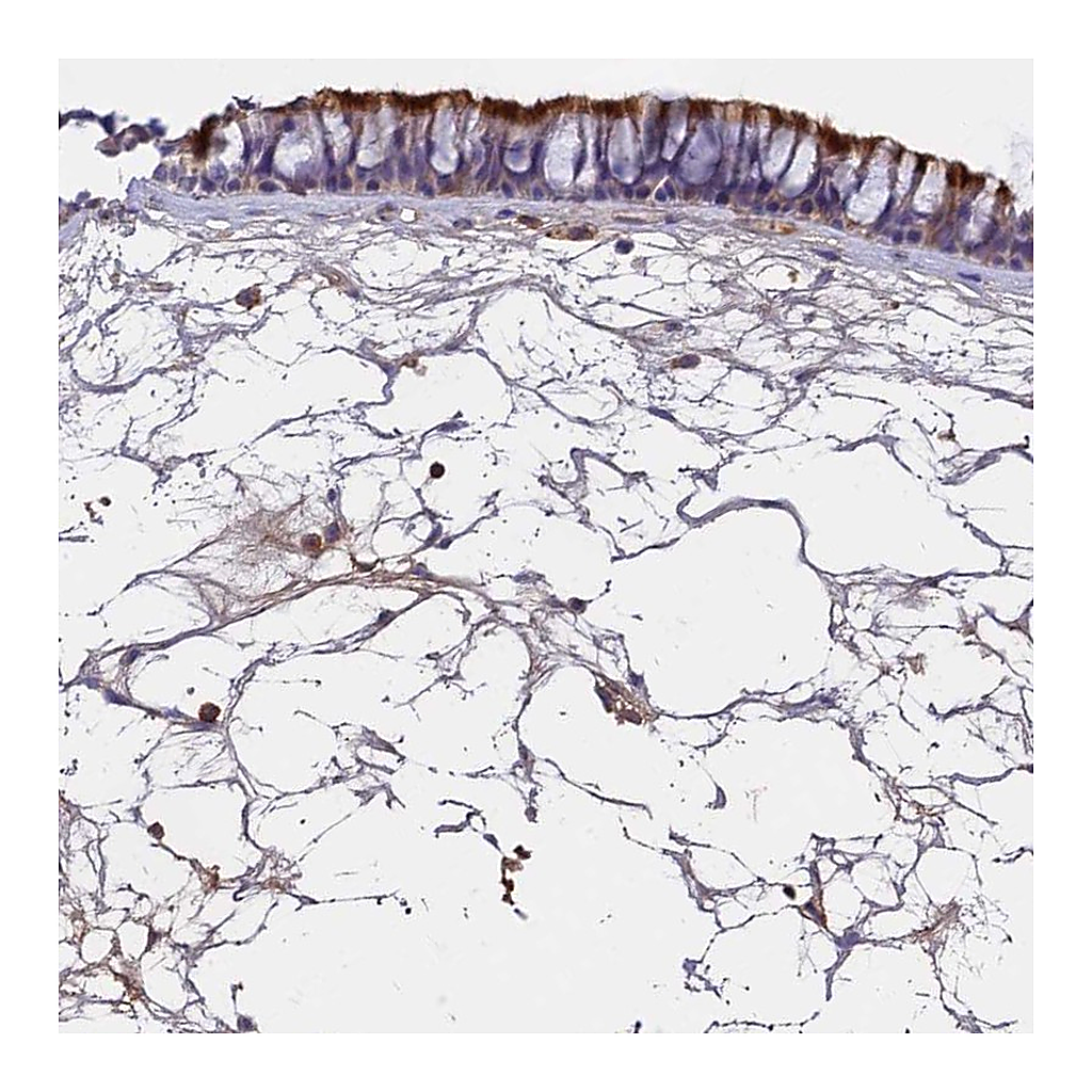Atlas Antibodies Anti-CCDC189 Antibody
