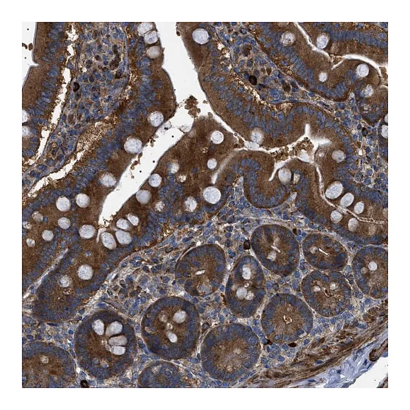 Atlas Antibodies Anti-CCDC186 Antibody