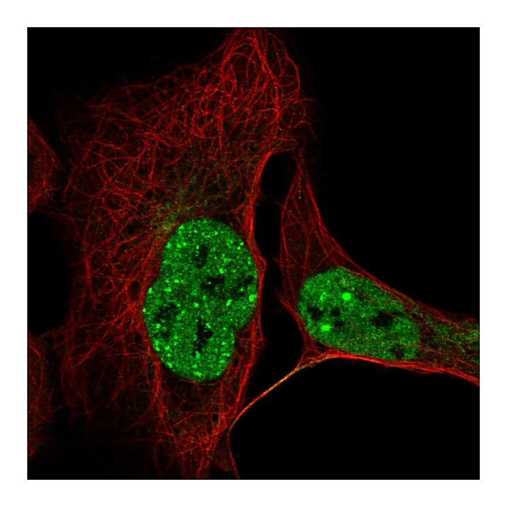 Atlas Antibodies Anti-CCDC188 Antibody