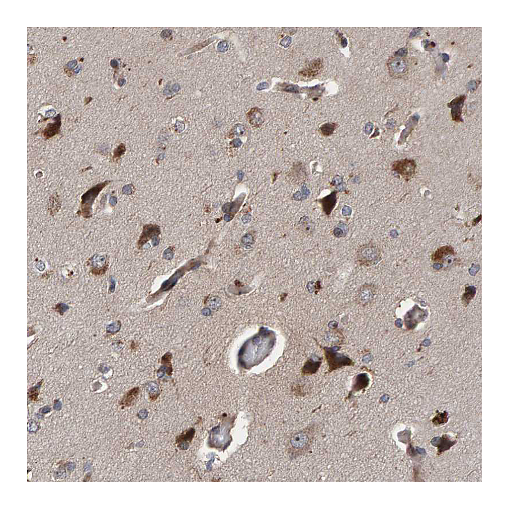 Atlas Antibodies Anti-CCDC25 Antibody