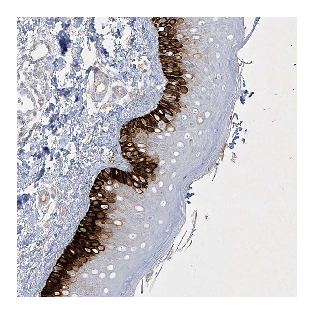 Atlas Antibodies Anti-CCDC24 Antibody