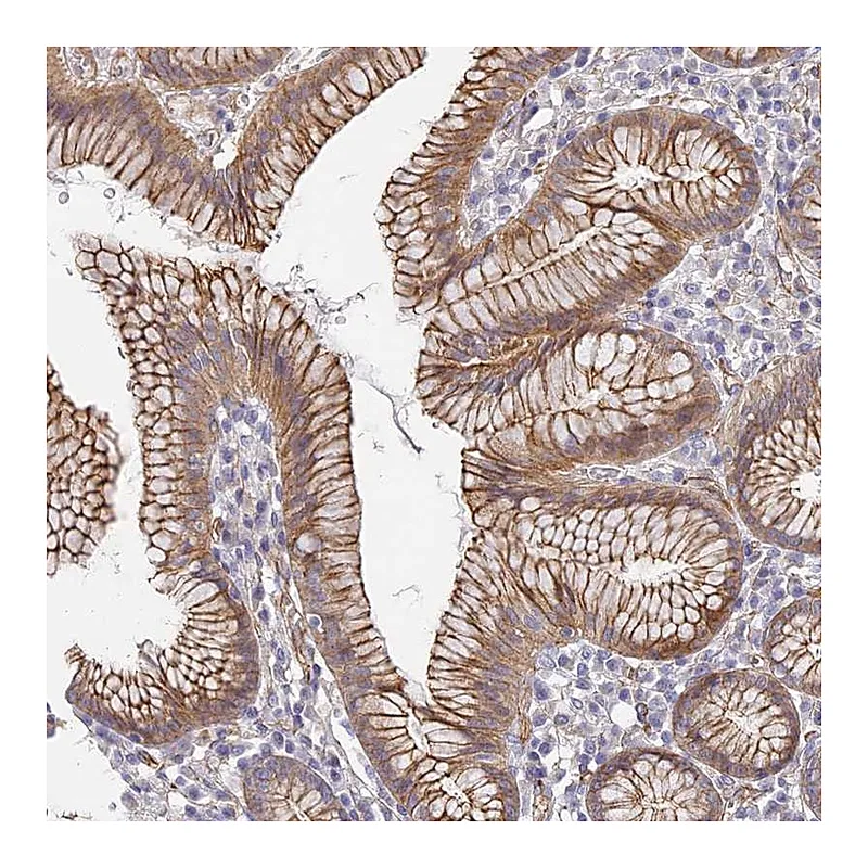 Atlas Antibodies Anti-CCDC30 Antibody