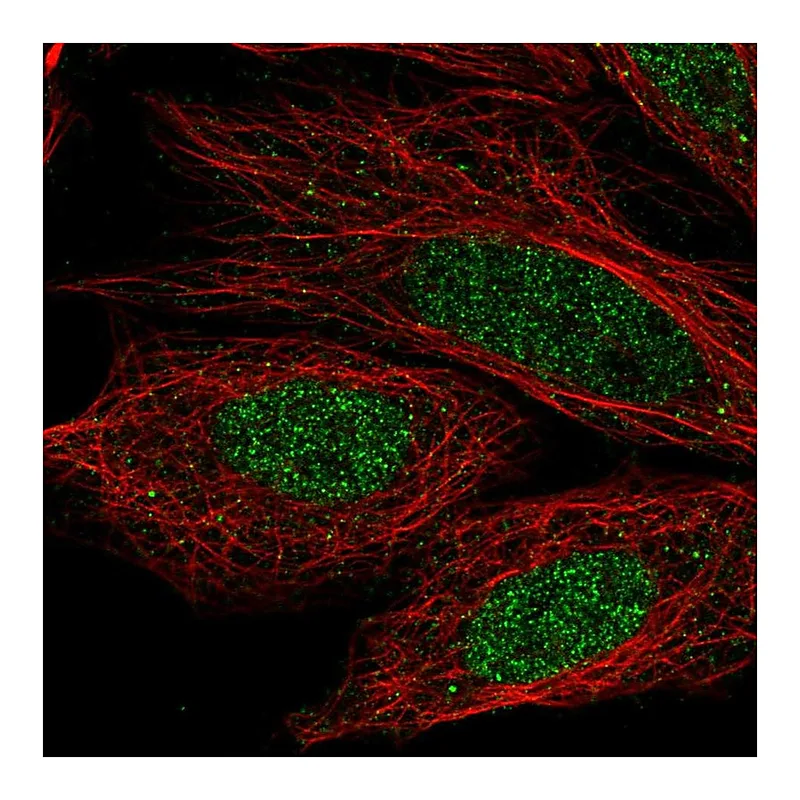 Atlas Antibodies Anti-CCDC36 Antibody
