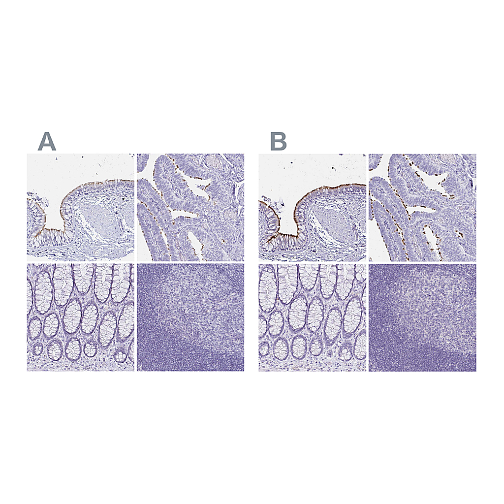 Atlas Antibodies Anti-CCDC39 Antibody