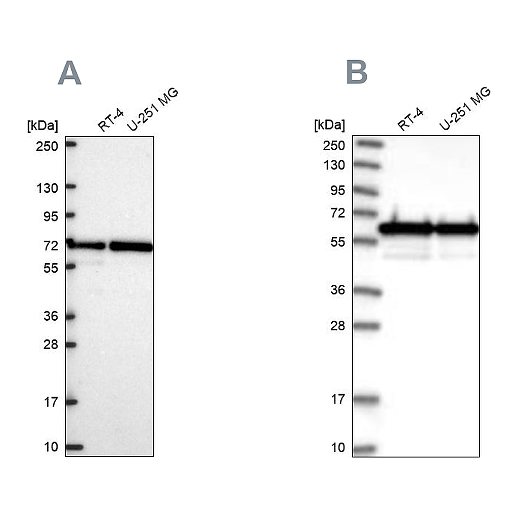 Atlas Antibodies Anti-CCDC47 Antibody
