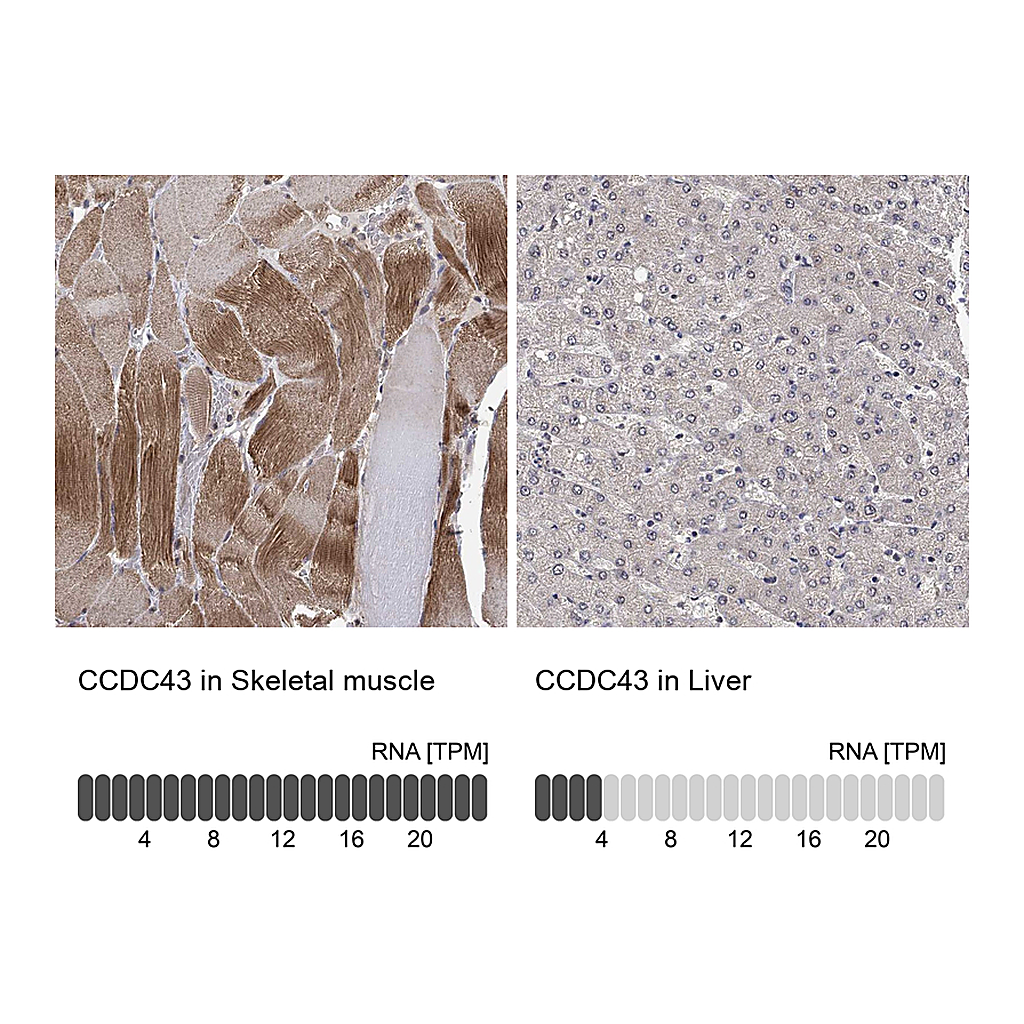 Atlas Antibodies Anti-CCDC43 Antibody