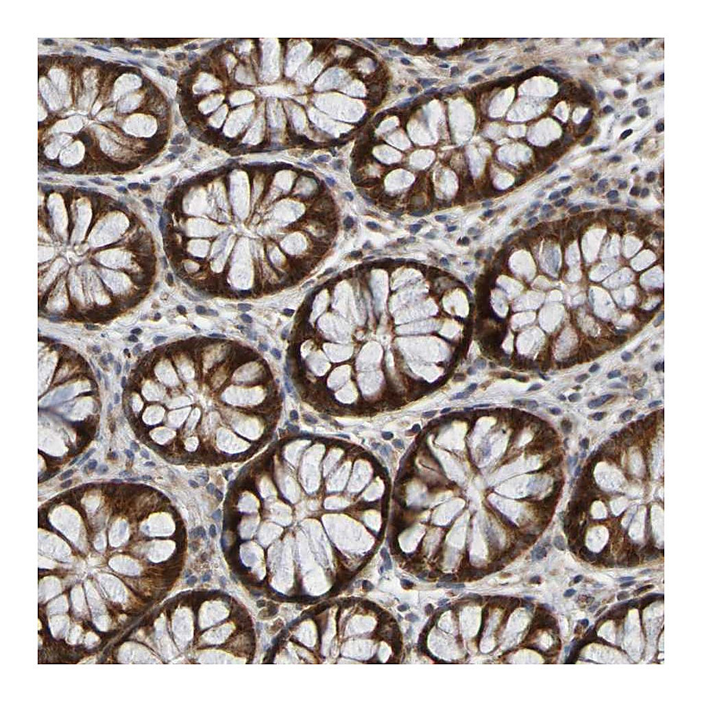 Atlas Antibodies Anti-CCDC51 Antibody