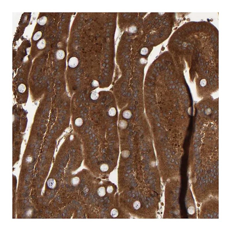 Atlas Antibodies Anti-CCDC57 Antibody
