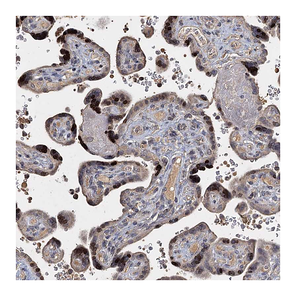 Atlas Antibodies Anti-CCDC61 Antibody