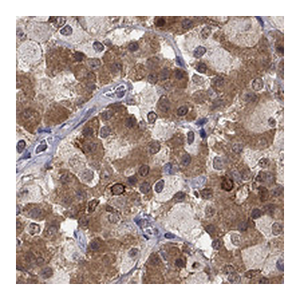 Atlas Antibodies Anti-CCDC66 Antibody