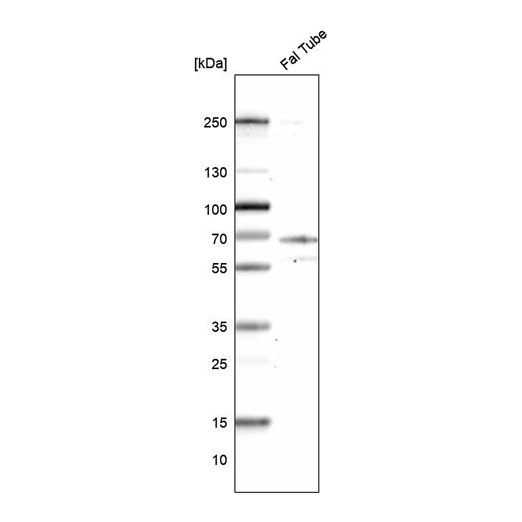 Atlas Antibodies Anti-CCDC65 Antibody
