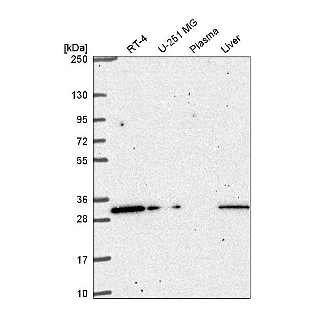 Atlas Antibodies Anti-CCDC69 Antibody