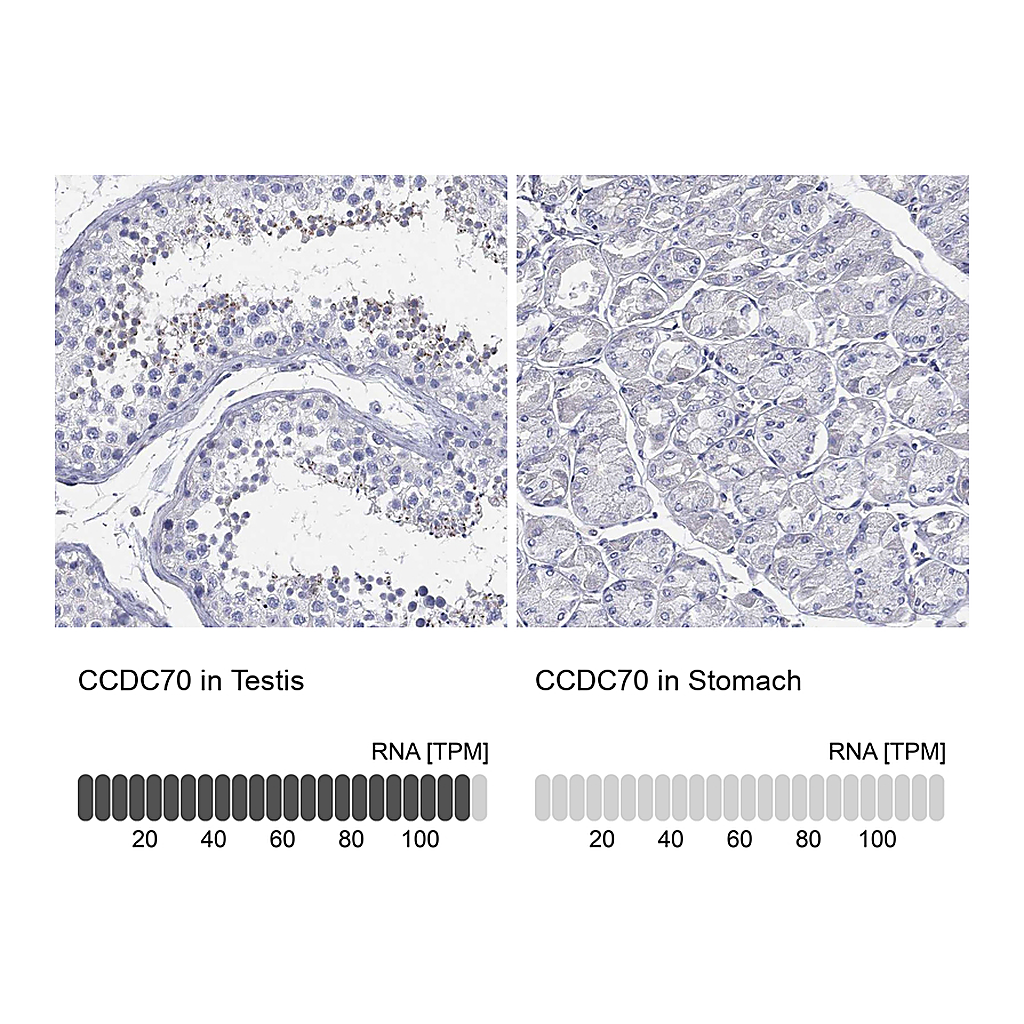 Atlas Antibodies Anti-CCDC70 Antibody