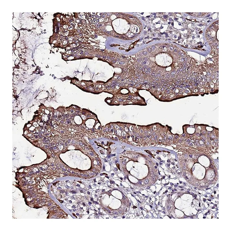 Atlas Antibodies Anti-CCDC71 Antibody