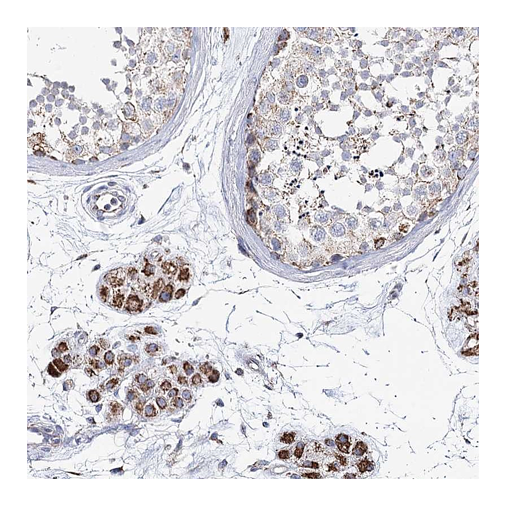 Atlas Antibodies Anti-CCDC73 Antibody