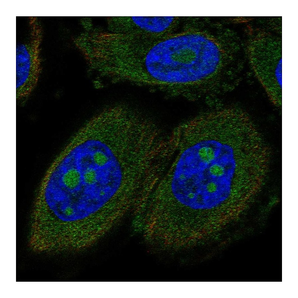 Atlas Antibodies Anti-CCDC7 Antibody