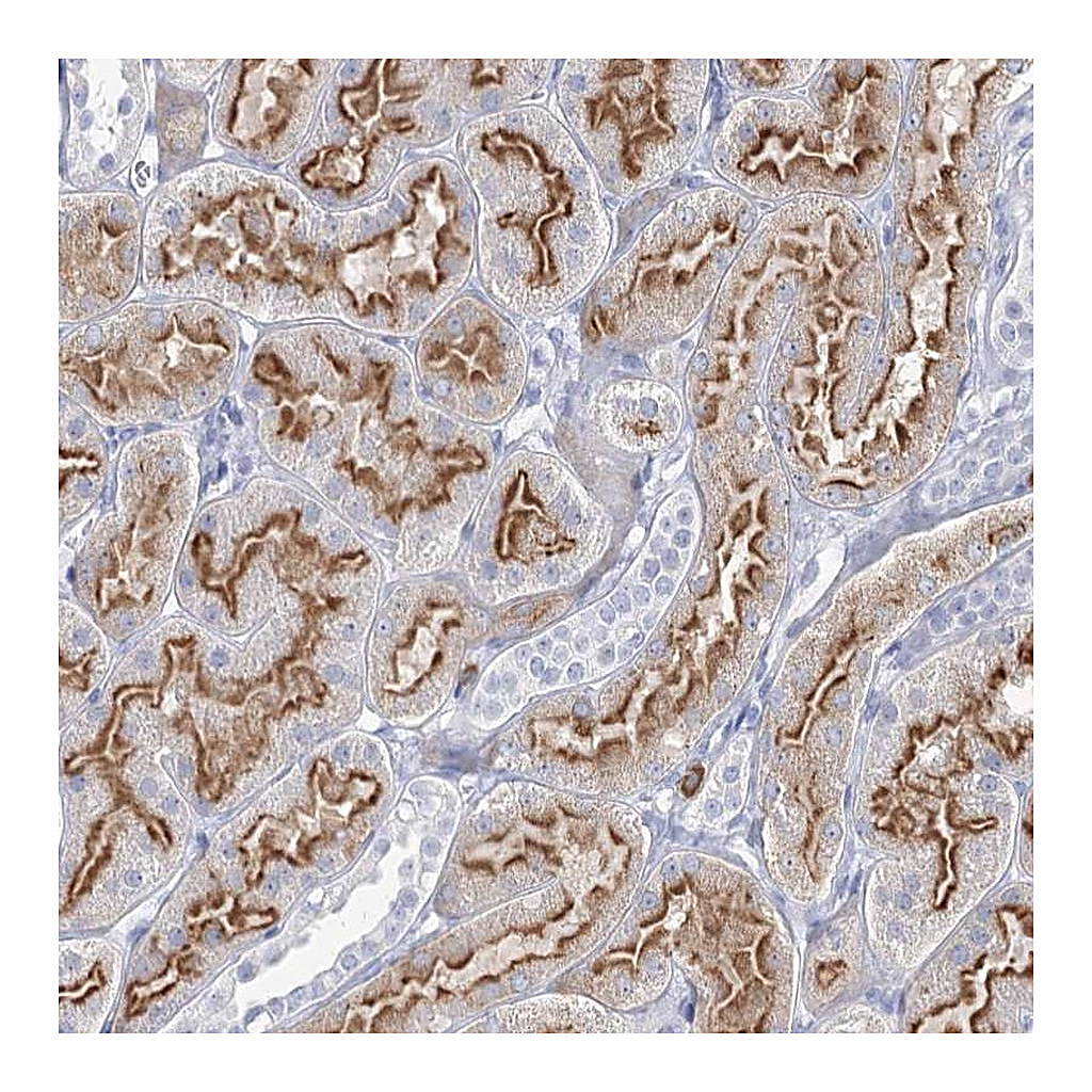 Atlas Antibodies Anti-CCDC73 Antibody