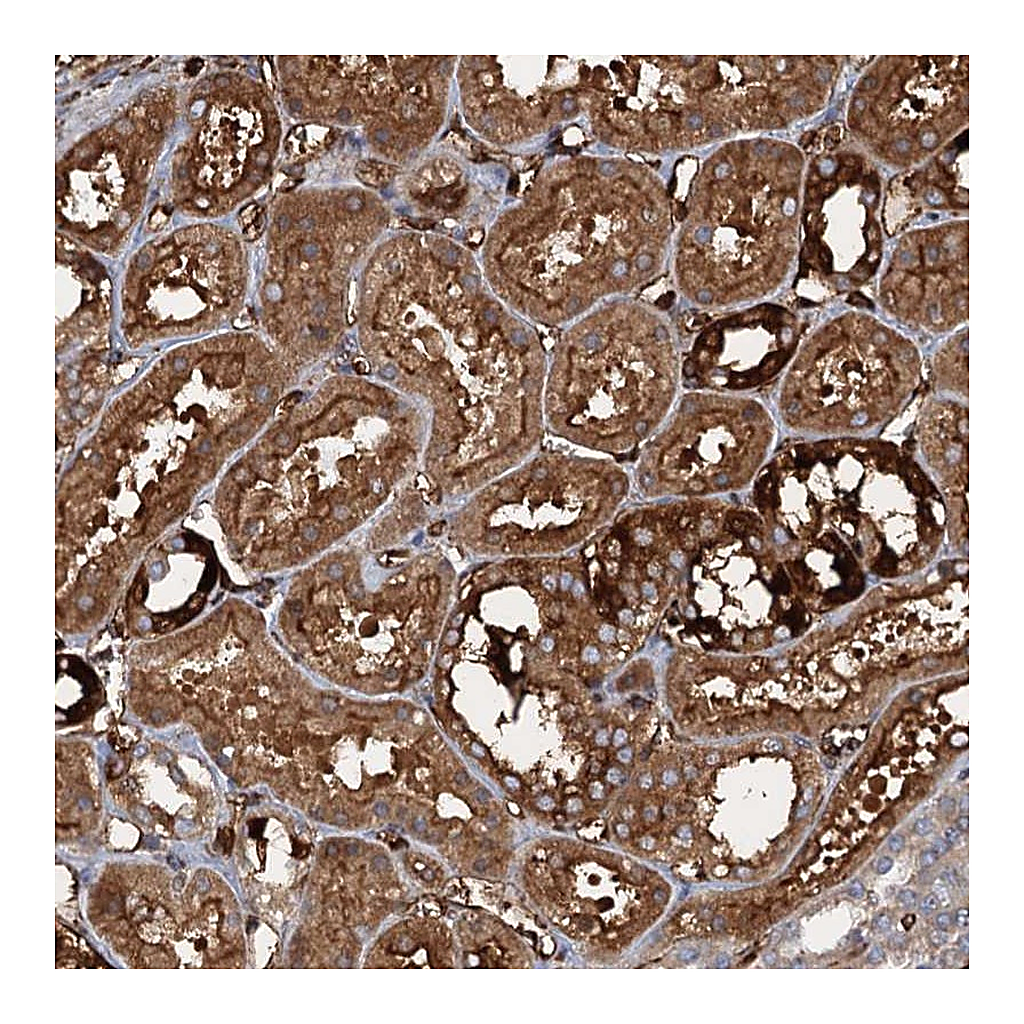 Atlas Antibodies Anti-CCDC81 Antibody