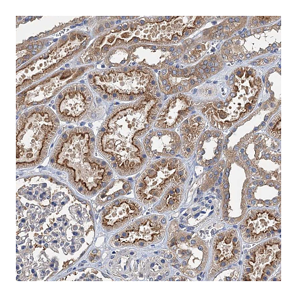Atlas Antibodies Anti-CCDC81 Antibody