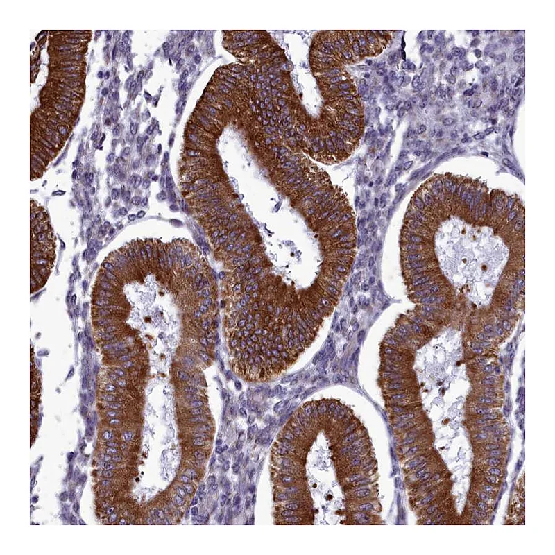 Atlas Antibodies Anti-CCDC84 Antibody