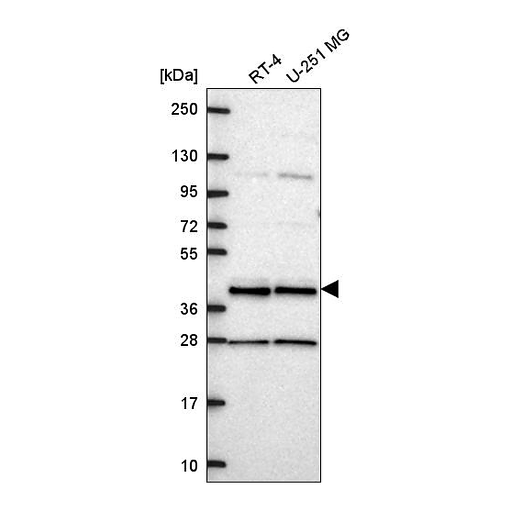Atlas Antibodies Anti-CCDC84 Antibody