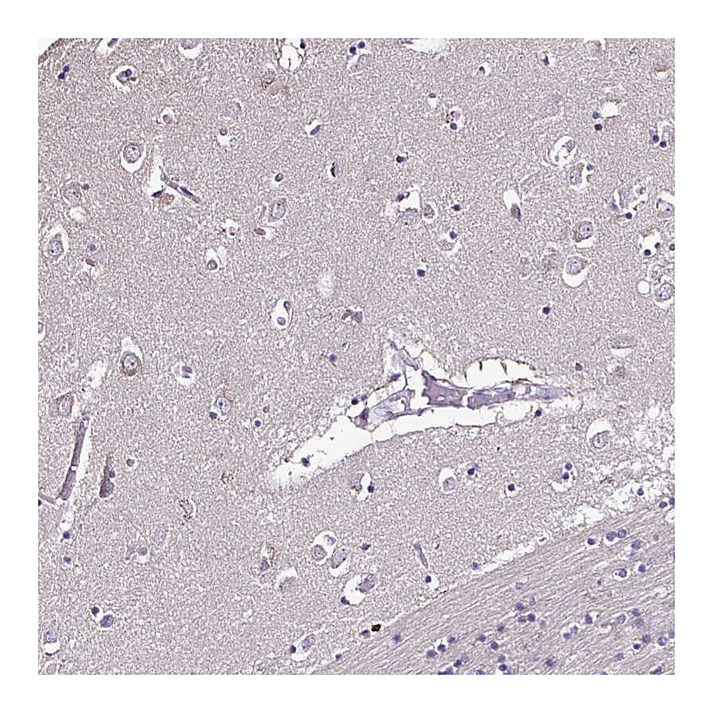 Atlas Antibodies Anti-CCDC85C Antibody