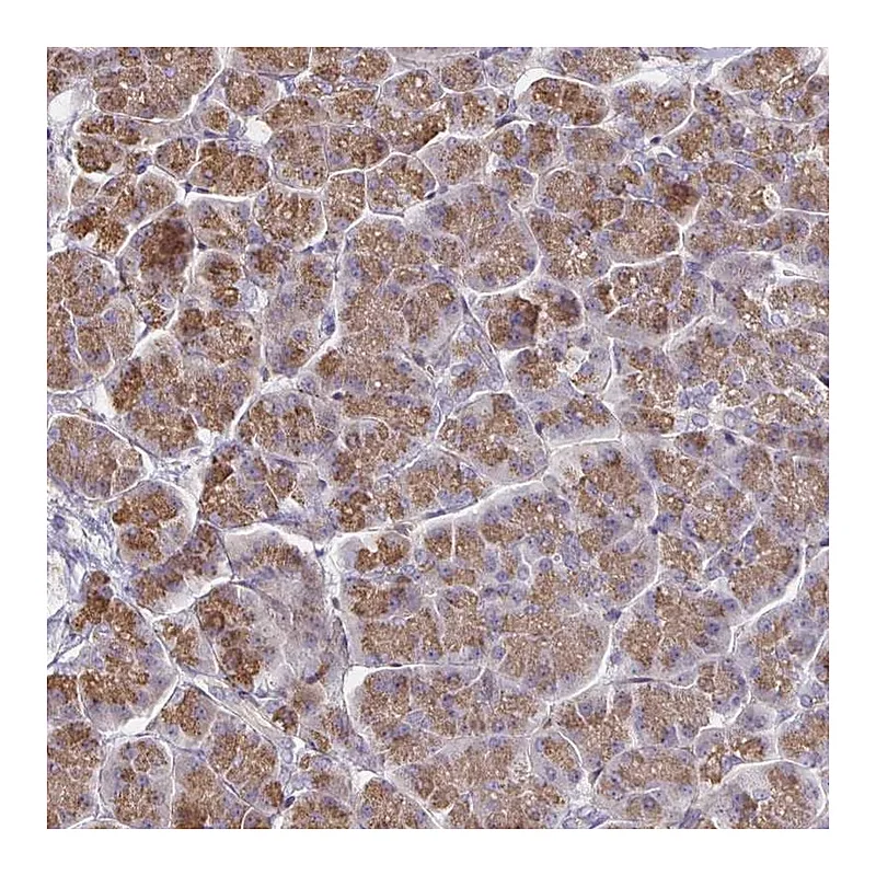 Atlas Antibodies Anti-CCDC85A Antibody
