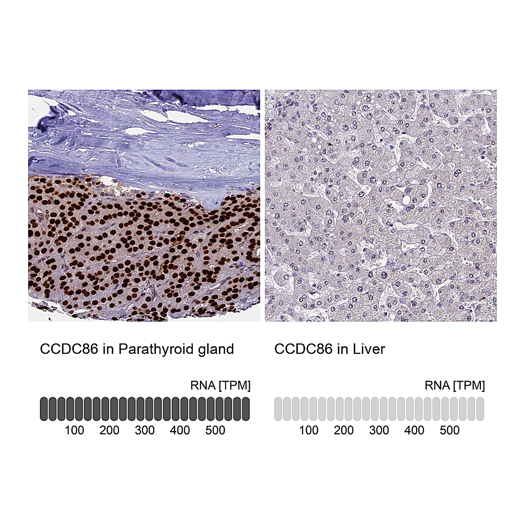 Atlas Antibodies Anti-CCDC86 Antibody