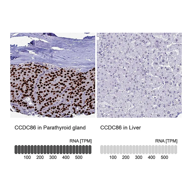Atlas Antibodies Anti-CCDC86 Antibody
