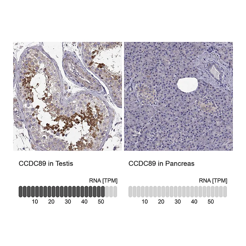 Atlas Antibodies Anti-CCDC89 Antibody