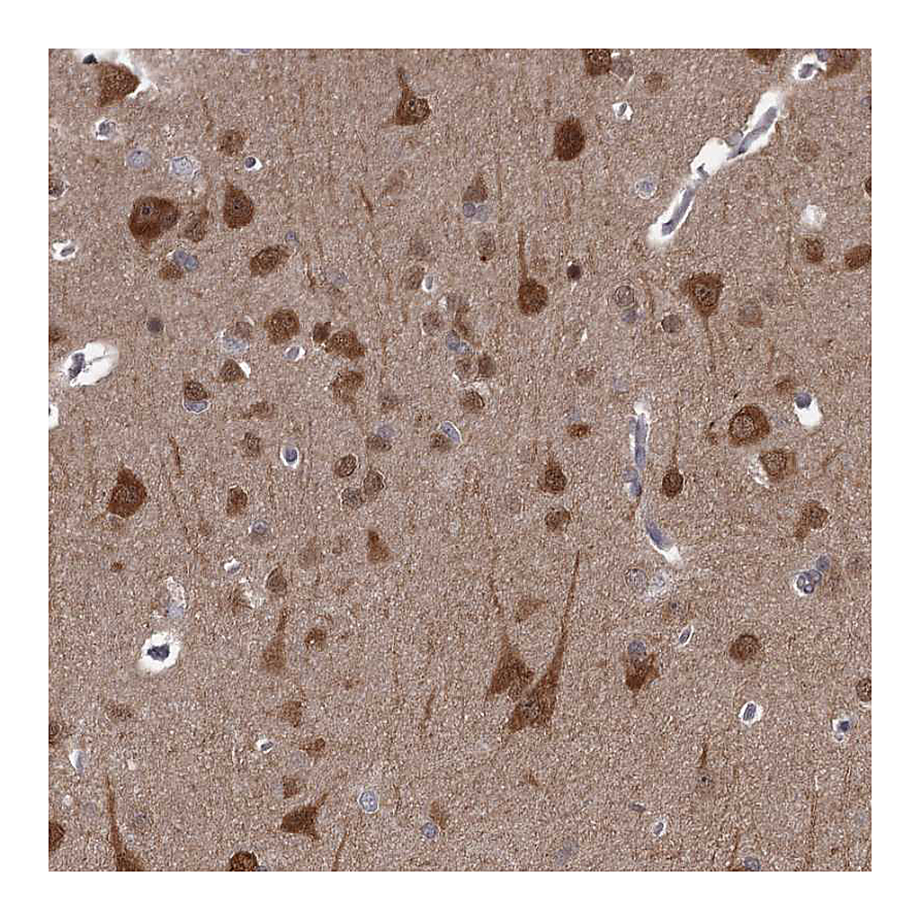 Atlas Antibodies Anti-CCDC92 Antibody