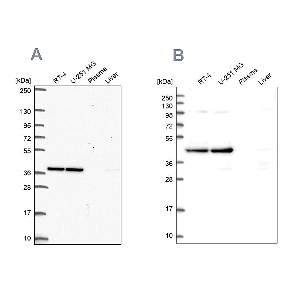 Atlas Antibodies Anti-CCDC94 Antibody
