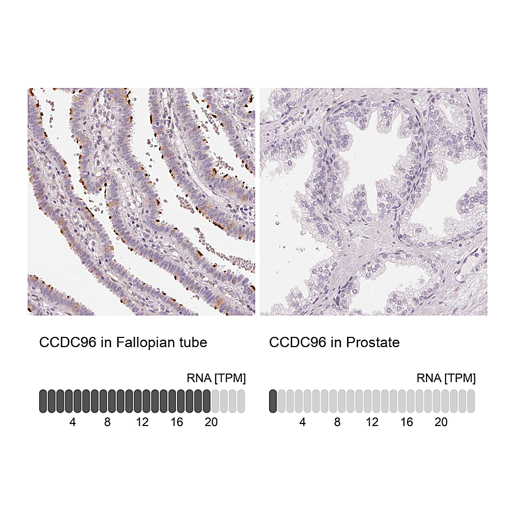 Atlas Antibodies Anti-CCDC96 Antibody