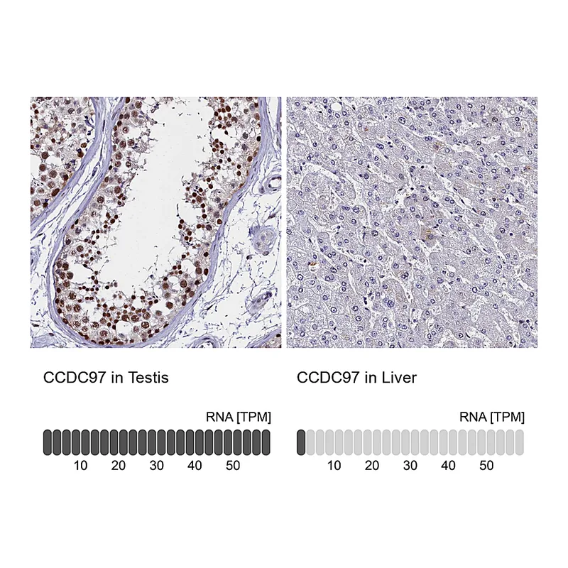 Atlas Antibodies Anti-CCDC97 Antibody