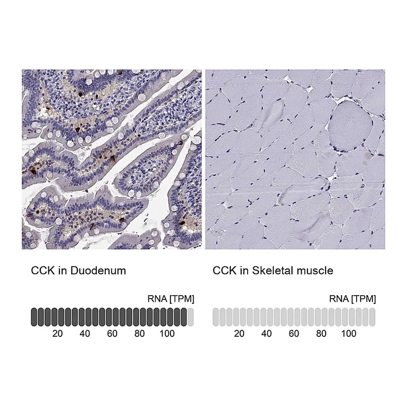 Atlas Antibodies Anti-CCK Antibody