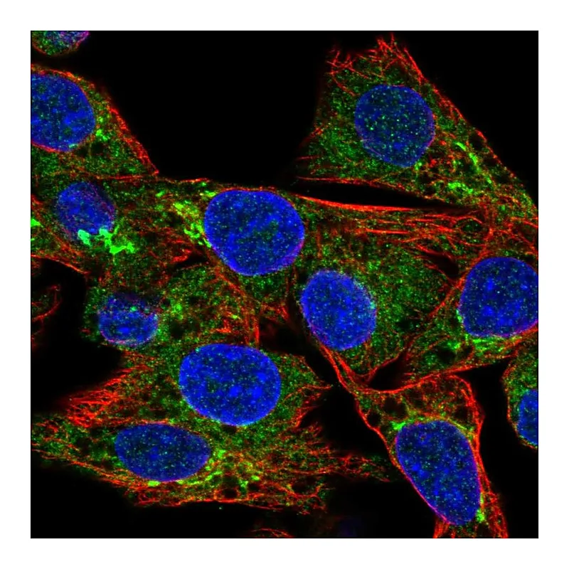 Atlas Antibodies Anti-CCL15 Antibody