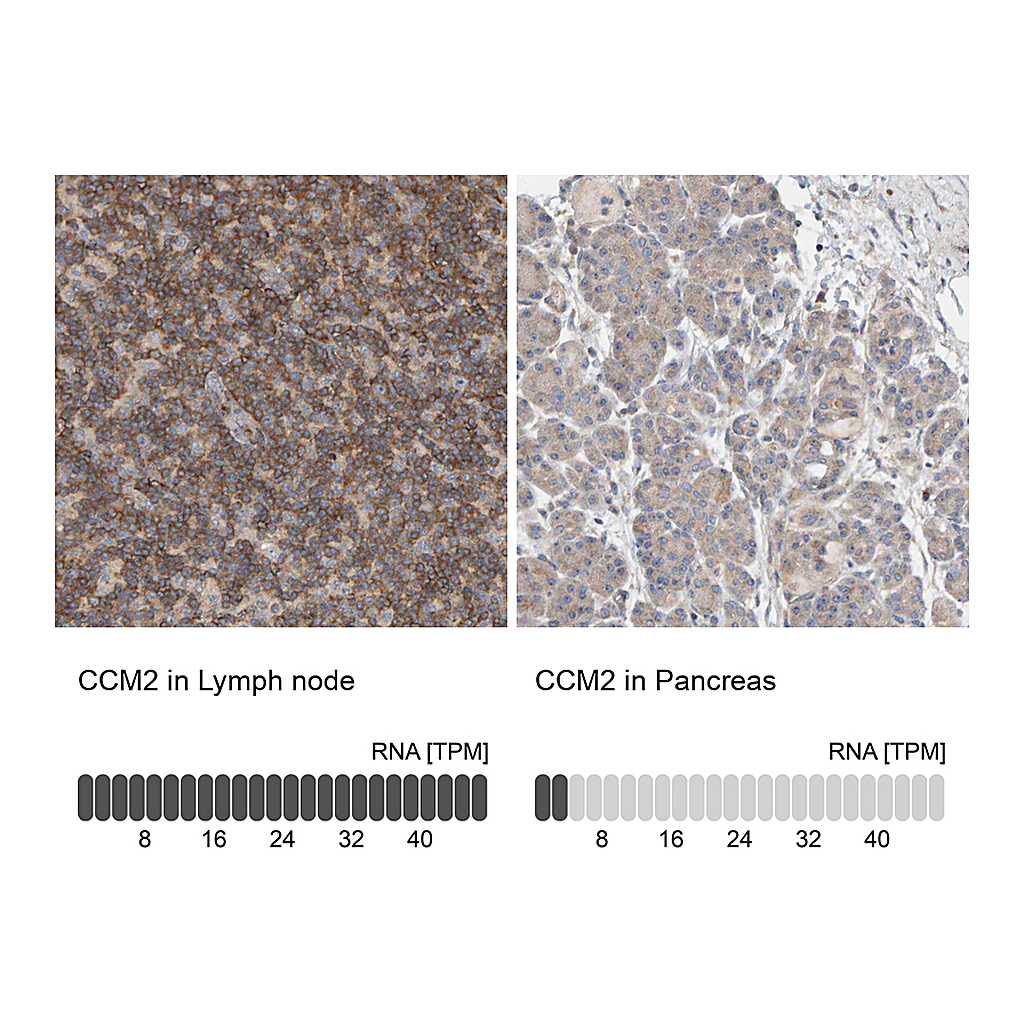 Atlas Antibodies Anti-CCM2 Antibody