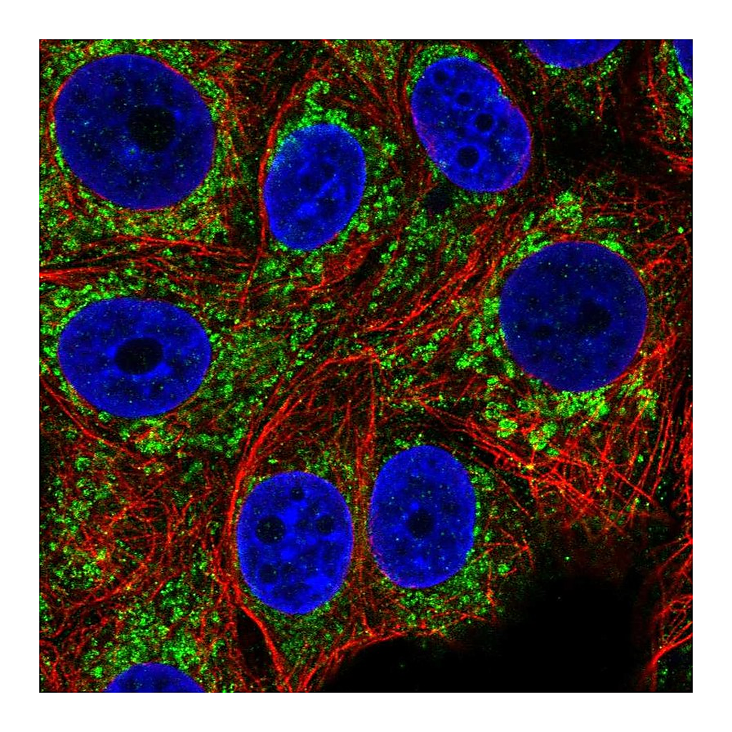 Atlas Antibodies Anti-CCM2 Antibody