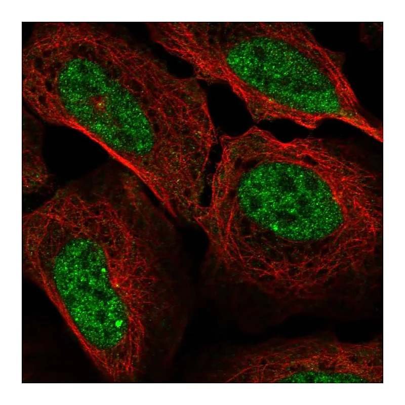 Atlas Antibodies Anti-CCNA1 Antibody
