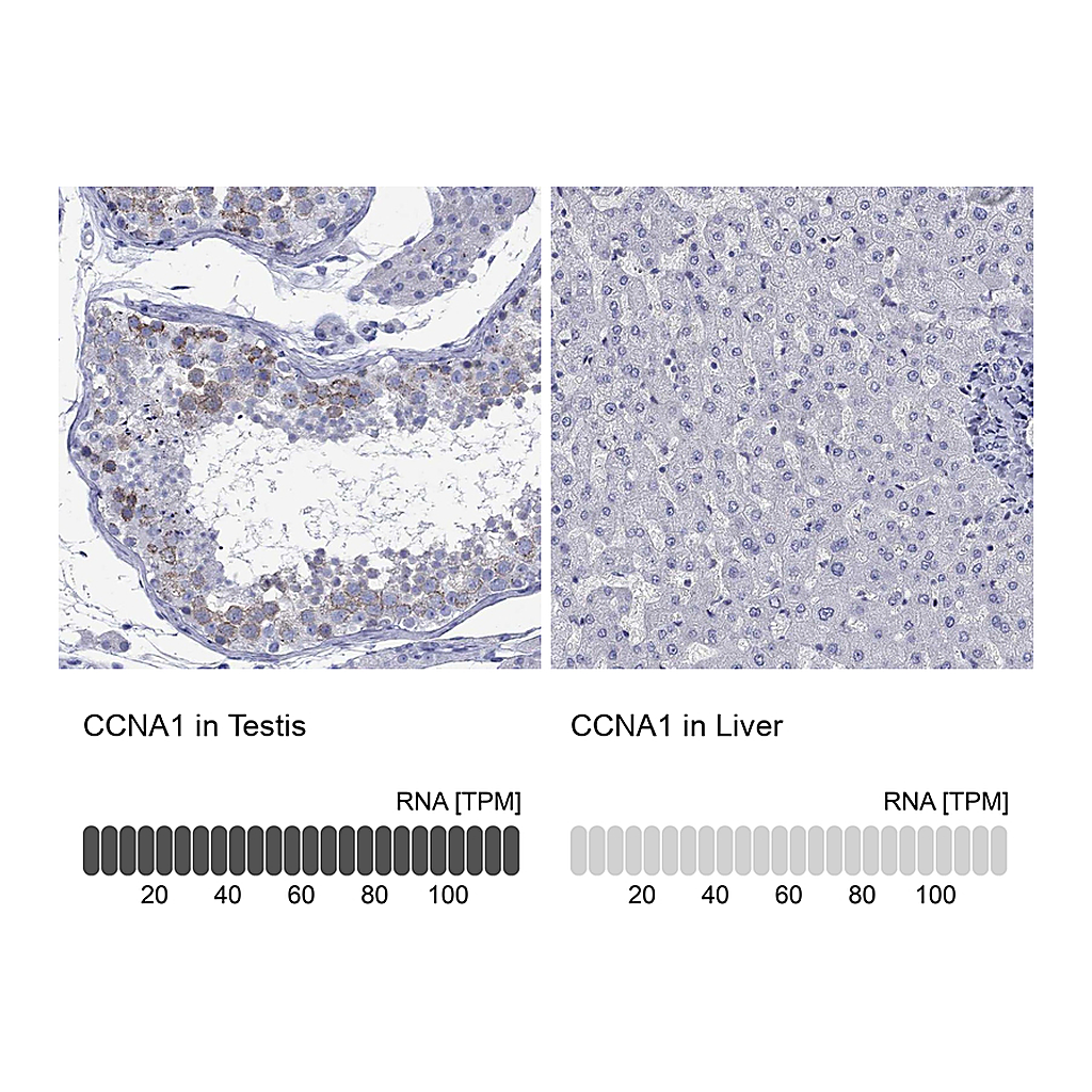 Atlas Antibodies Anti-CCNA1 Antibody