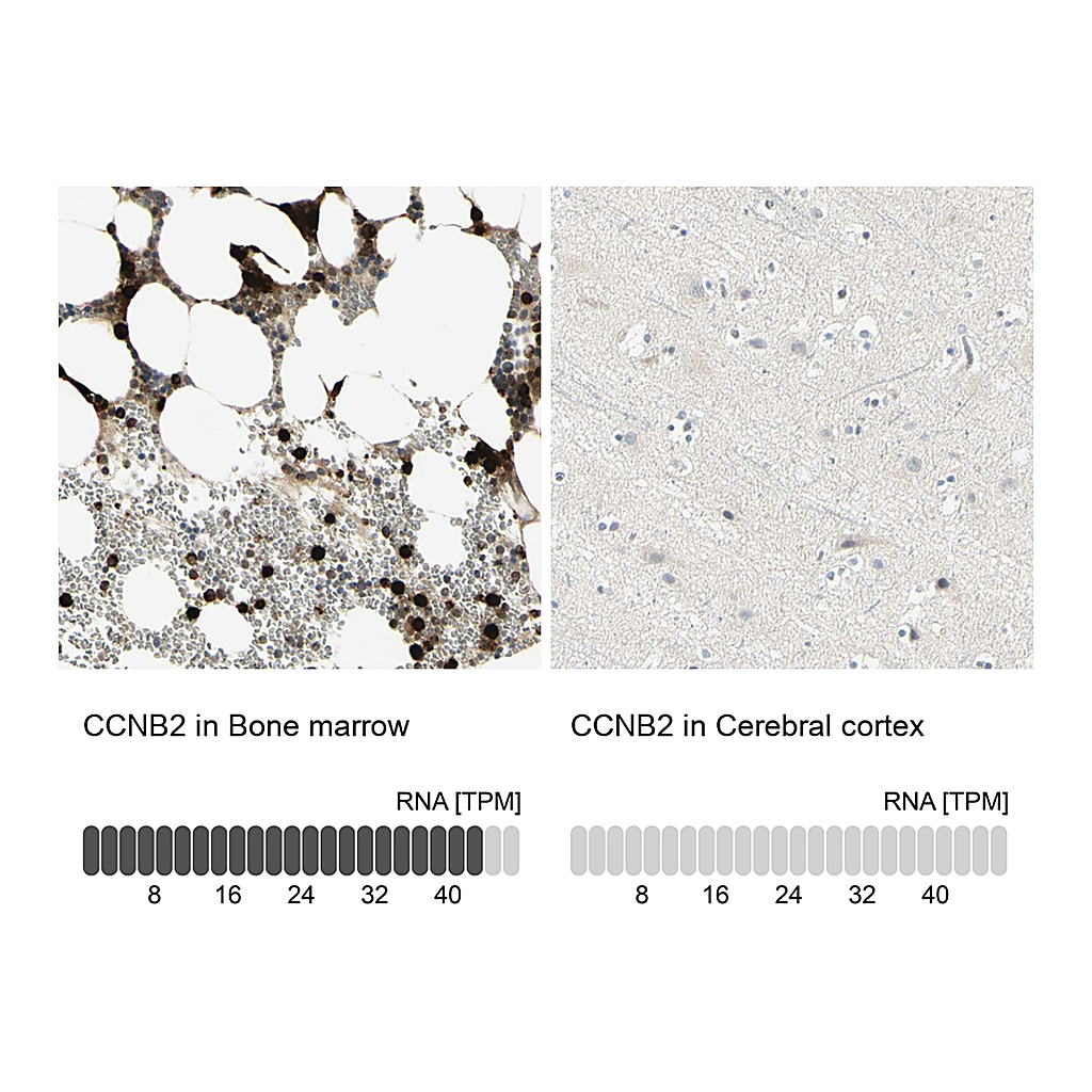 Atlas Antibodies Anti-CCNB2 Antibody
