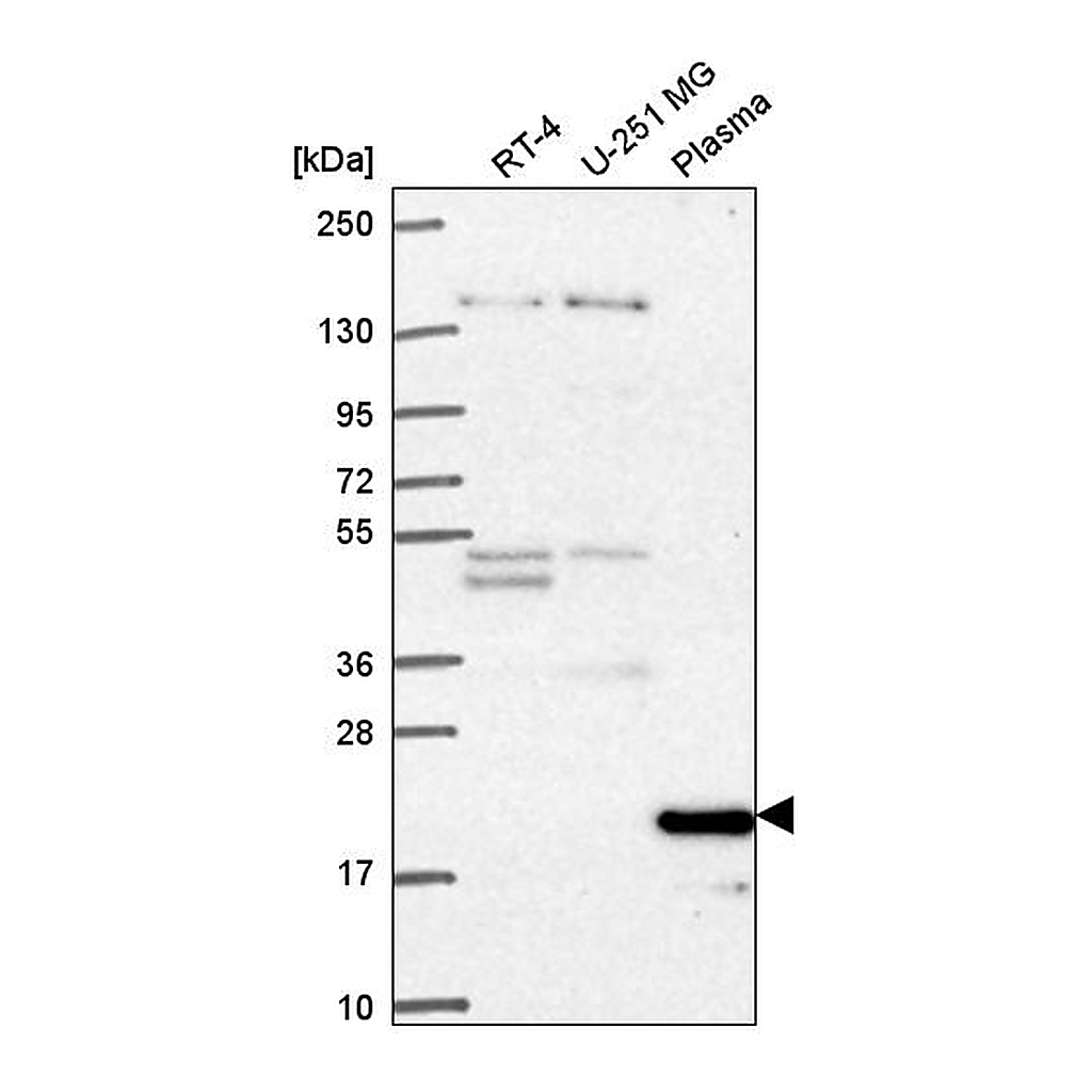 Atlas Antibodies Anti-CCNC Antibody