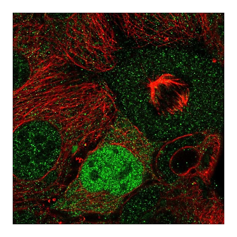 Atlas Antibodies Anti-CCND2 Antibody