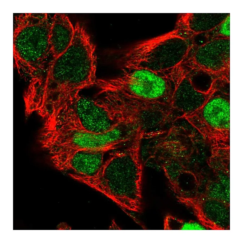 Atlas Antibodies Anti-CCND2 Antibody