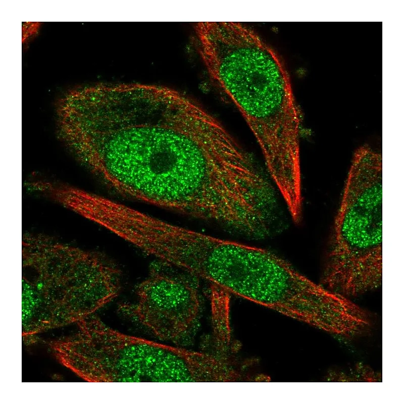Atlas Antibodies Anti-CCNH Antibody