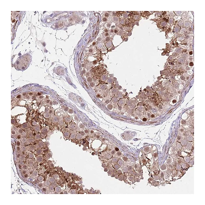 Atlas Antibodies Anti-CCNI Antibody